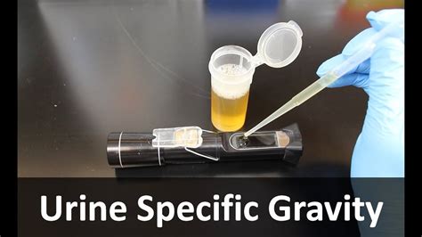 refractometric specific gravity